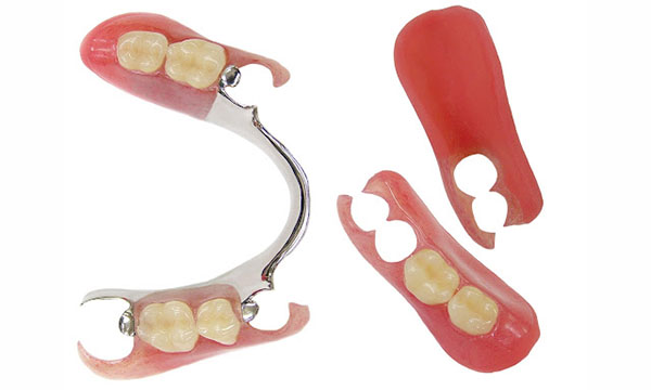 レジン床の入れ歯