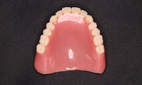 レジン床の入れ歯