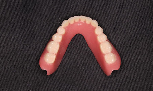 レジン床の入れ歯