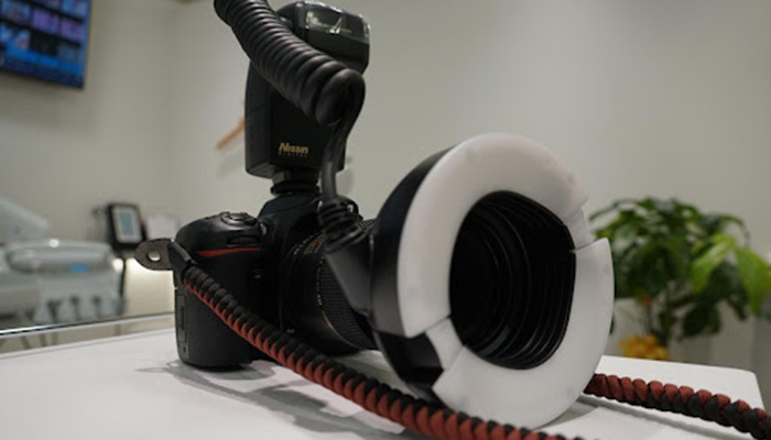 口腔内の撮影をするためのカメラの写真