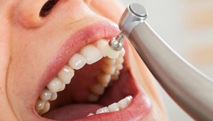 歯科医院の歯のクリーニング専用の機械で歯を磨かれている様子