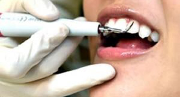 超音波の振動で汚れを落とすイメージ写真