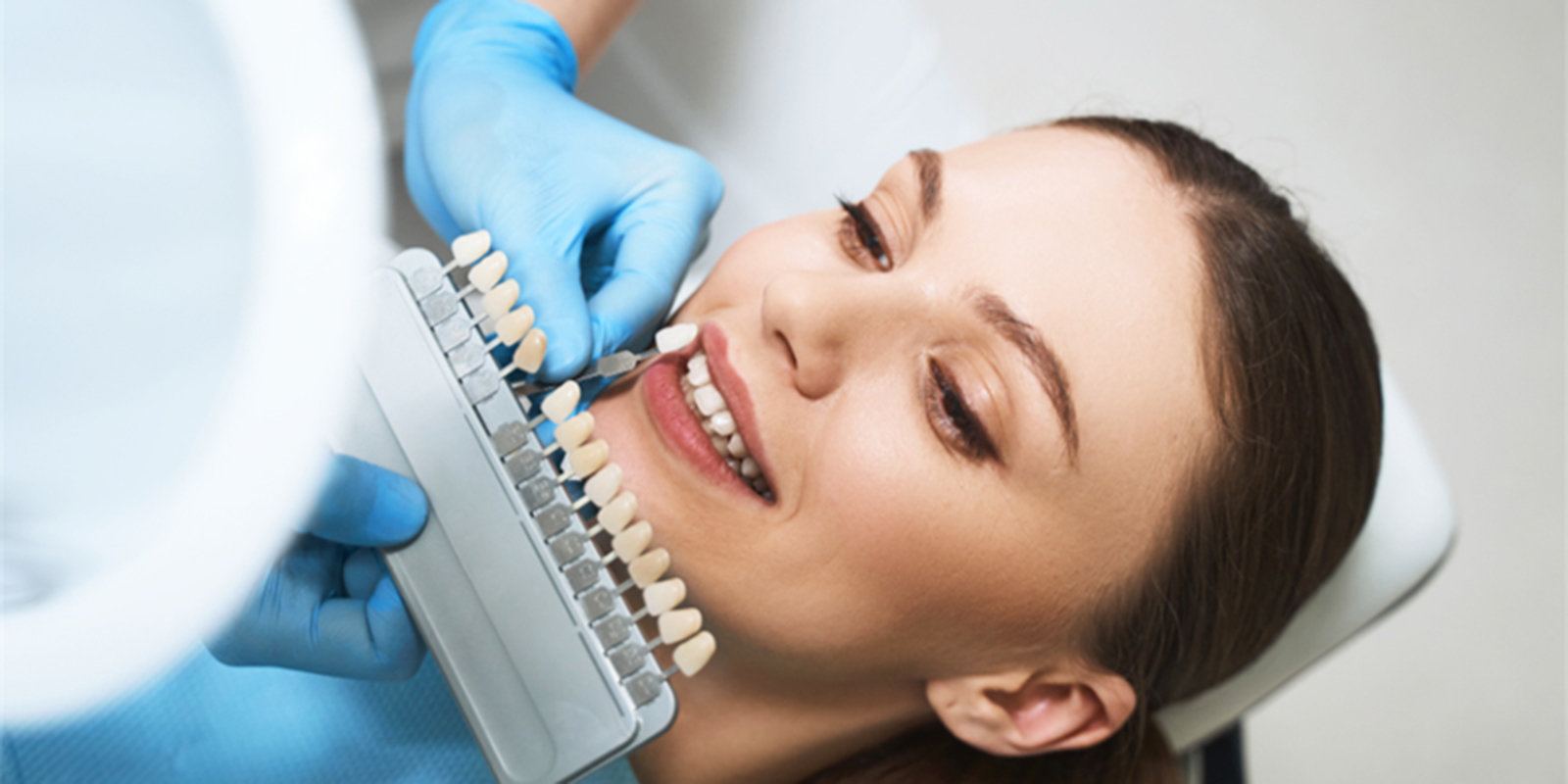 シェードガイドという色を確認するための歯の見本を歯に近づけ鏡で確認し、色味の確認をしている様子