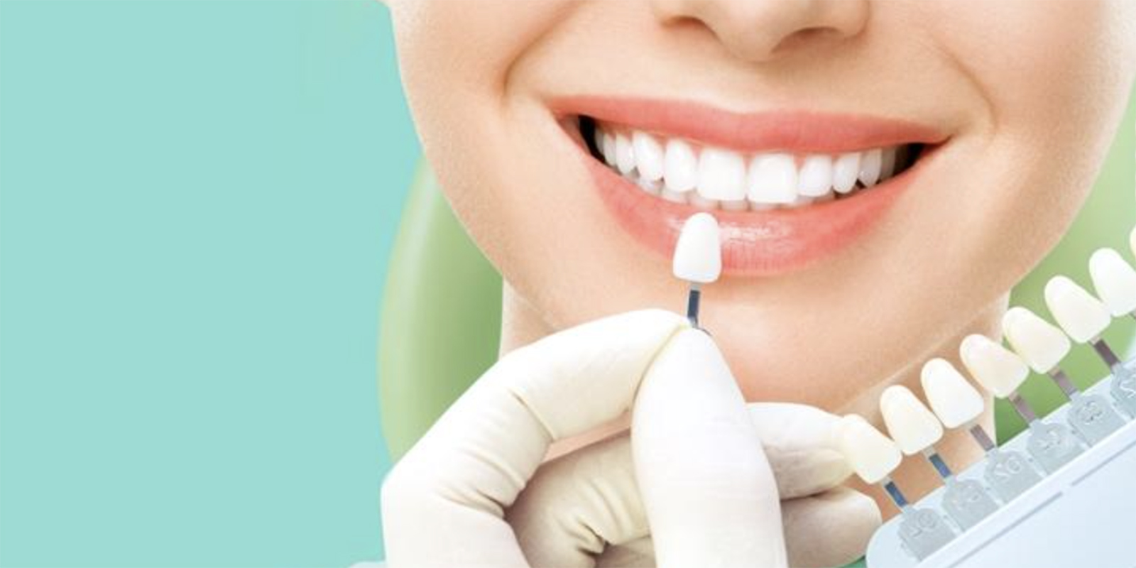 シェードガイドという色を確認するための歯の見本を歯に近づけ、色味の確認をしている様子