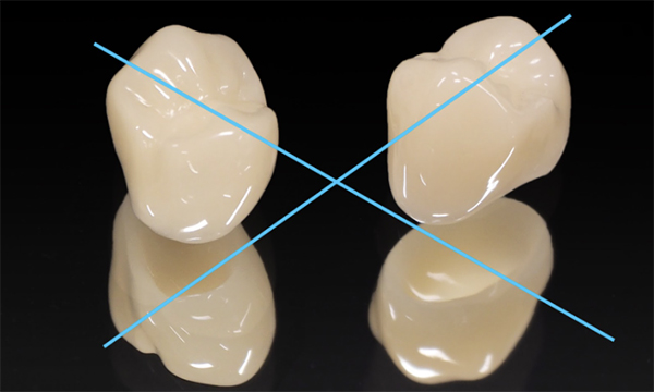 人工の被せ物であるセラミックの写真に×印を付けている画像