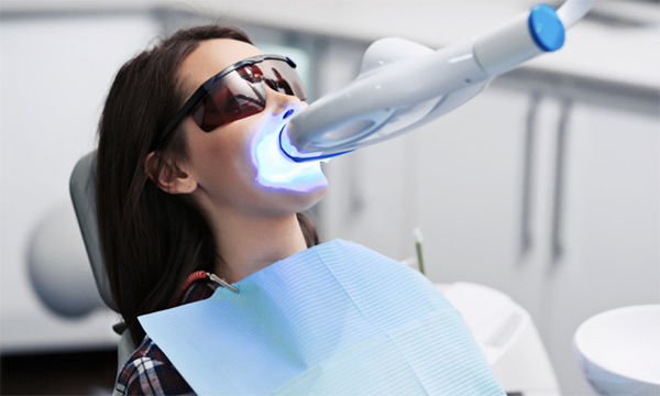 東松原でオフィスホワイトニングを受けるイメージ