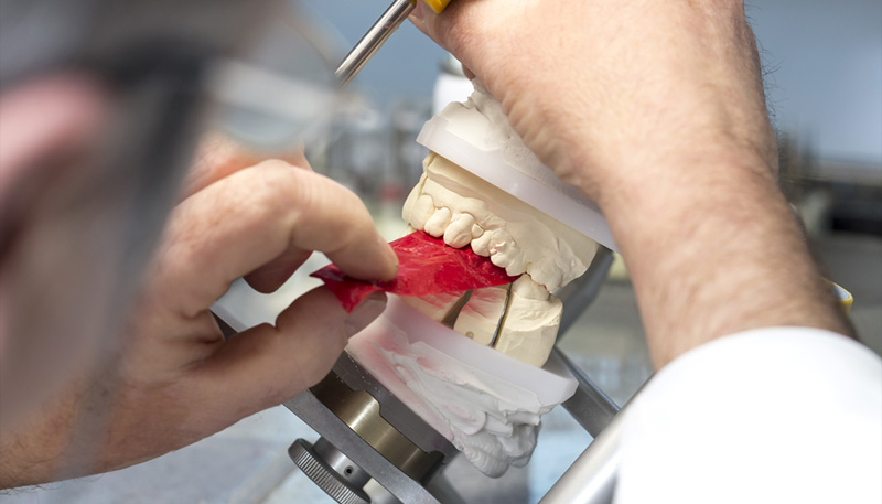 お口の中の模型でかみ合わせをチェックしている様子