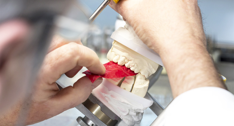 上下の歯の模型を使用し、かみ合わせを確認する紙を噛ませてかみ合わせを確認しているイメージ