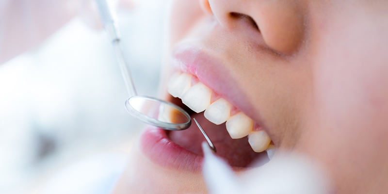 歯科医院で口腔内チェックを受けている様子