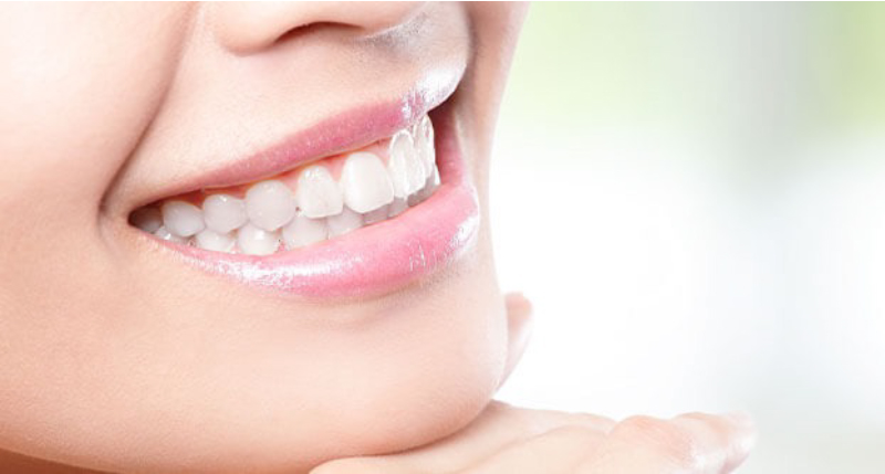 顎を手に置き、白い歯を見せながら微笑む女性の口元