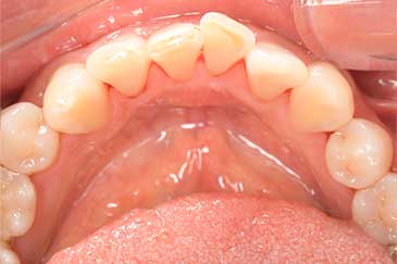 case12症例写真 施術前