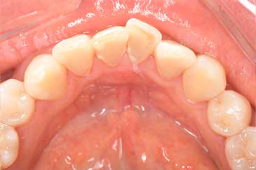 case12症例写真 施術前