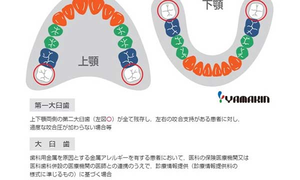 CADCAM冠適用部位についての画像