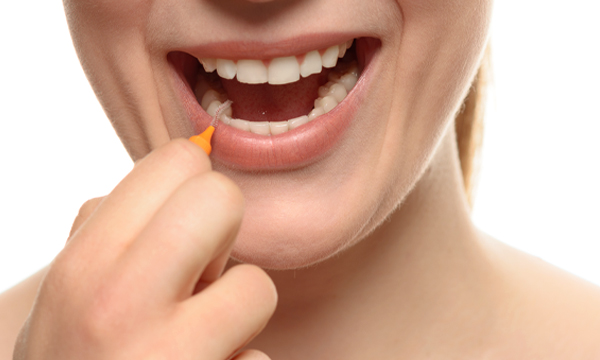 歯間ブラシを歯と歯の間に挿しこむ女性の写真