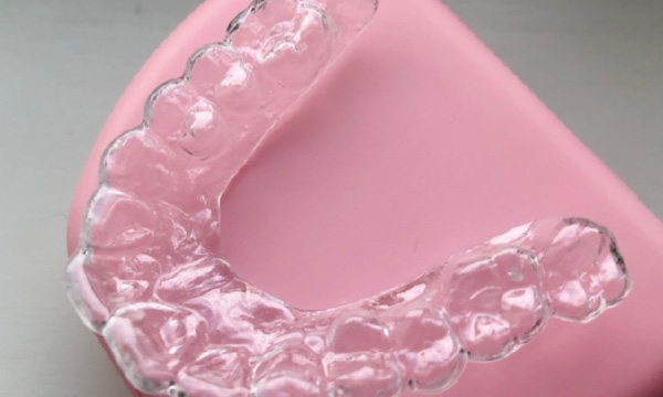 夜間の歯ぎしり等から歯を守る為のマウスピース