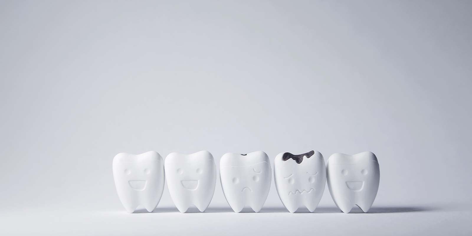 5本並ぶ歯の模型の内1本が虫歯になっている画像