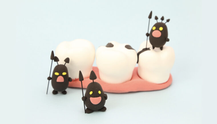 そもそも虫歯の原因とは？