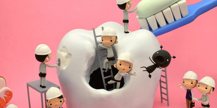 虫歯になった大きな歯の模型を作業員数名が治そうとするイメージ