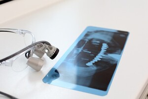 歯科用ルーペとレントゲン写真