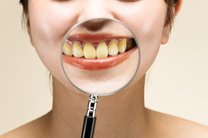 虫眼鏡で口元をアップにし、黄ばんだ歯を見ている様子