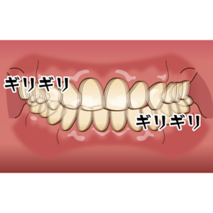 歯ぎしりをしている様子のイメージイラスト